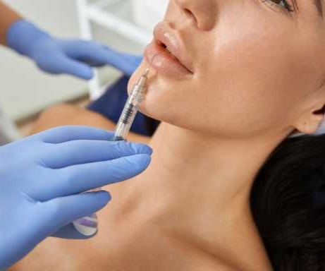 فیلر لب چیست؟ ماندگاری، عوارض و هزینه تزریق فیلر لب