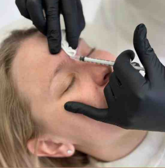 بوتاکس چیست؟ راهنمای کامل تزریق بوتاکس صورت